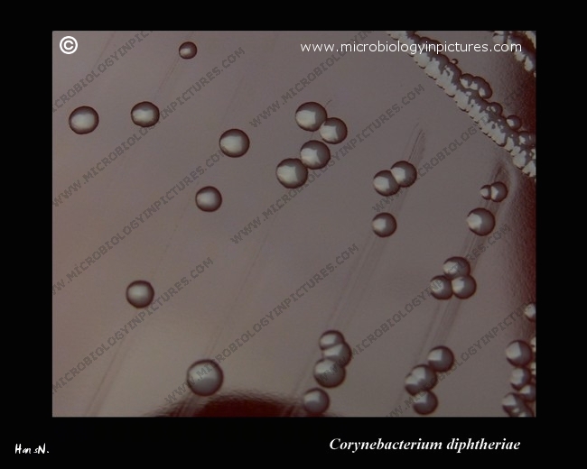 c.diphtheriae colonies